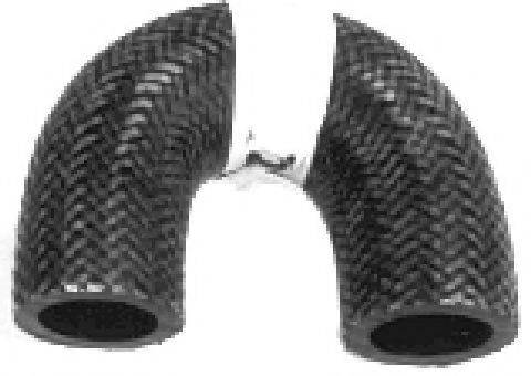 Шланг радиатора 08214 METALCAUCHO